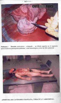WMD reccomend nude man autopsy
