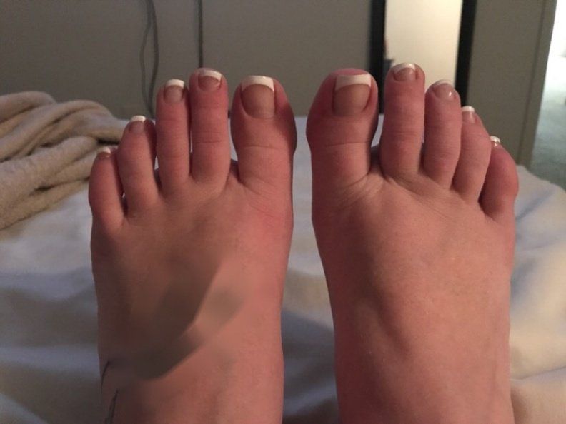 Fourth D. recommendet toes wife