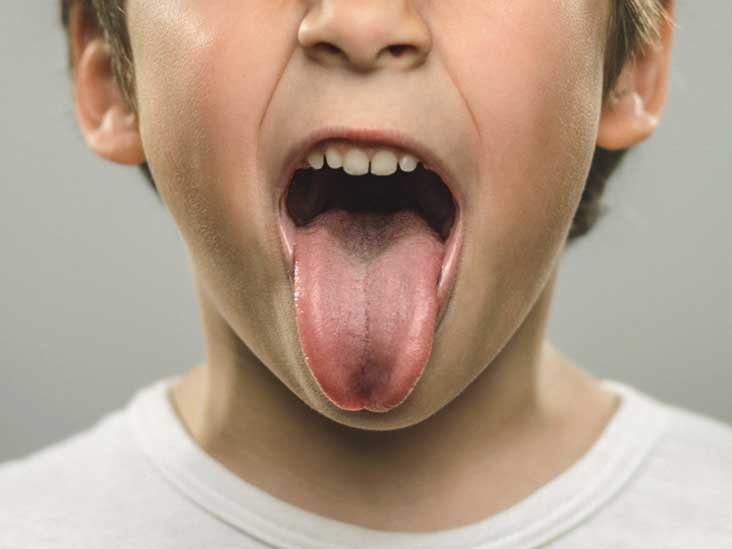 Gummy B. reccomend Get your tongue deep