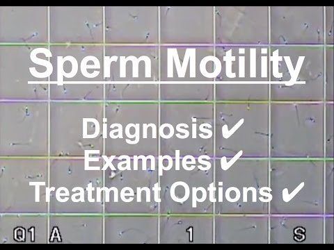 best of Sperm Treatment motility for