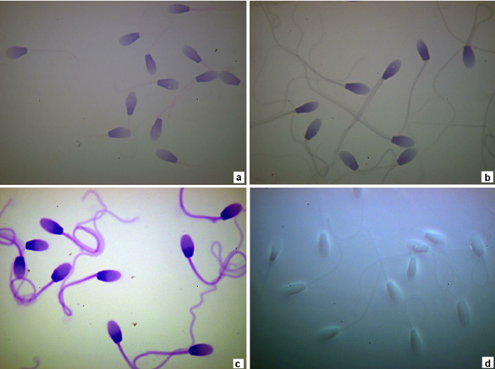 Papanicolau stain and sperm