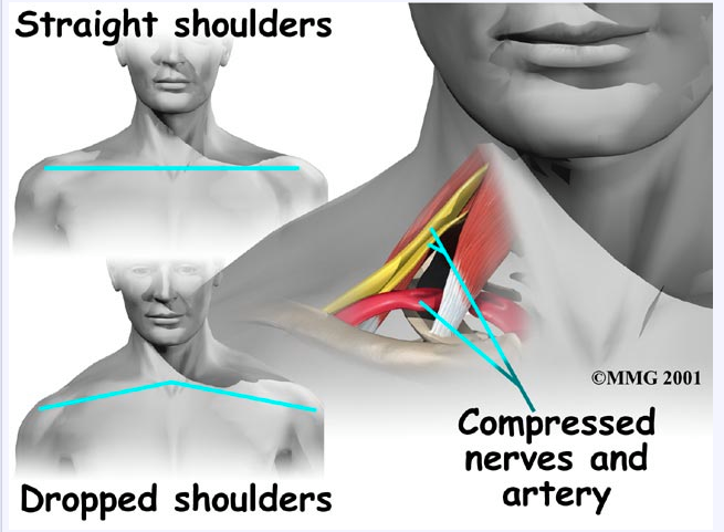 Facial numbness and shoulder pain