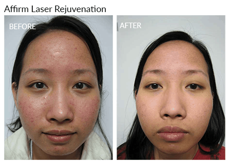 Jessica R. reccomend Facial rejuvenation reviews