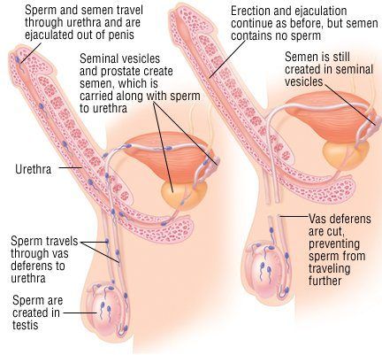 Female ejaculating sperm