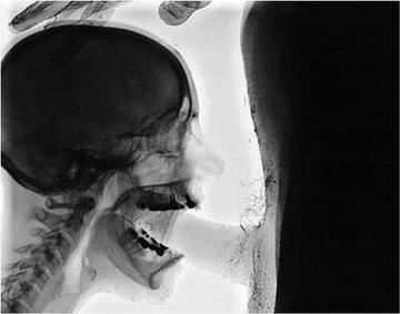 best of Throat in X-ray cock of