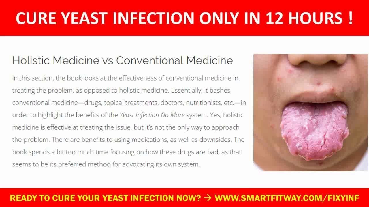 Anal yeast infection in men