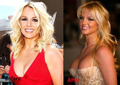 Britney spears boob photo
