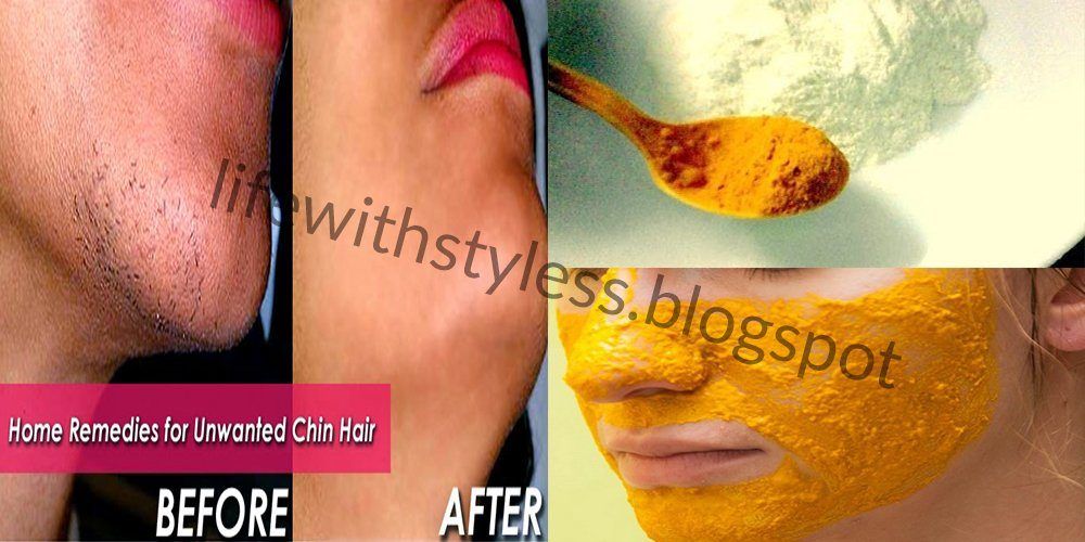 Natural remedy for eliminating facial hair
