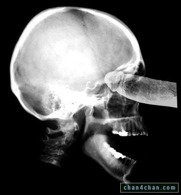 Uncle reccomend X-ray of cock in throat