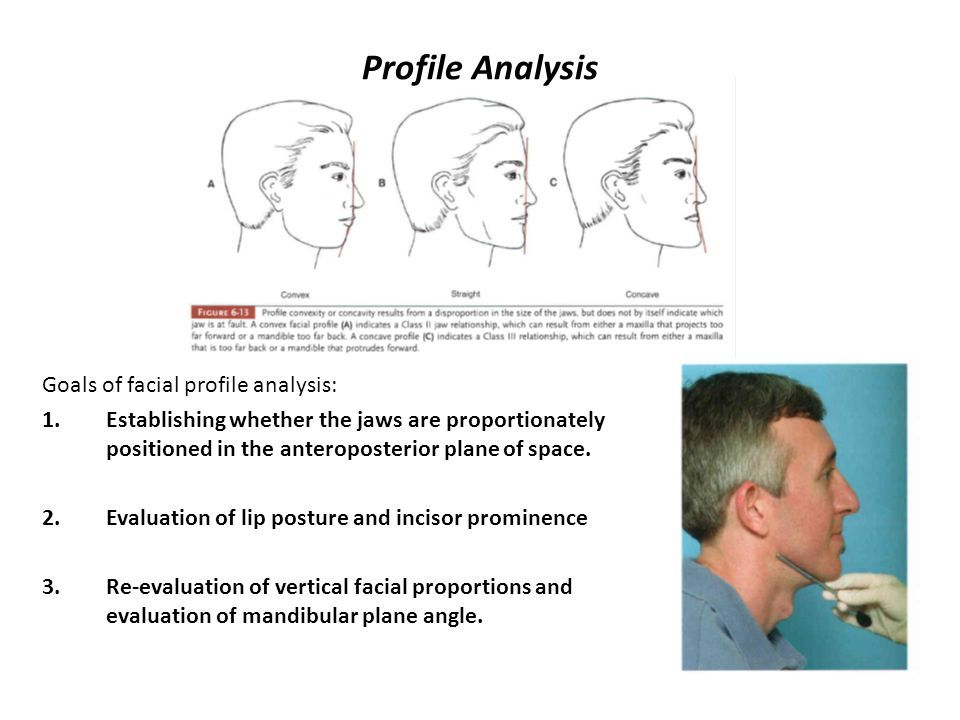 best of Profile Facial analysis facial