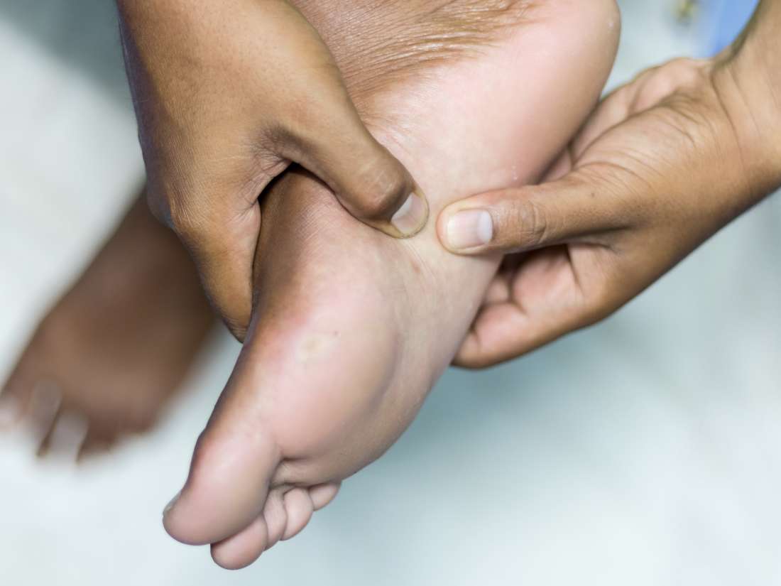 Trinity reccomend Foot hard spots pain bottom
