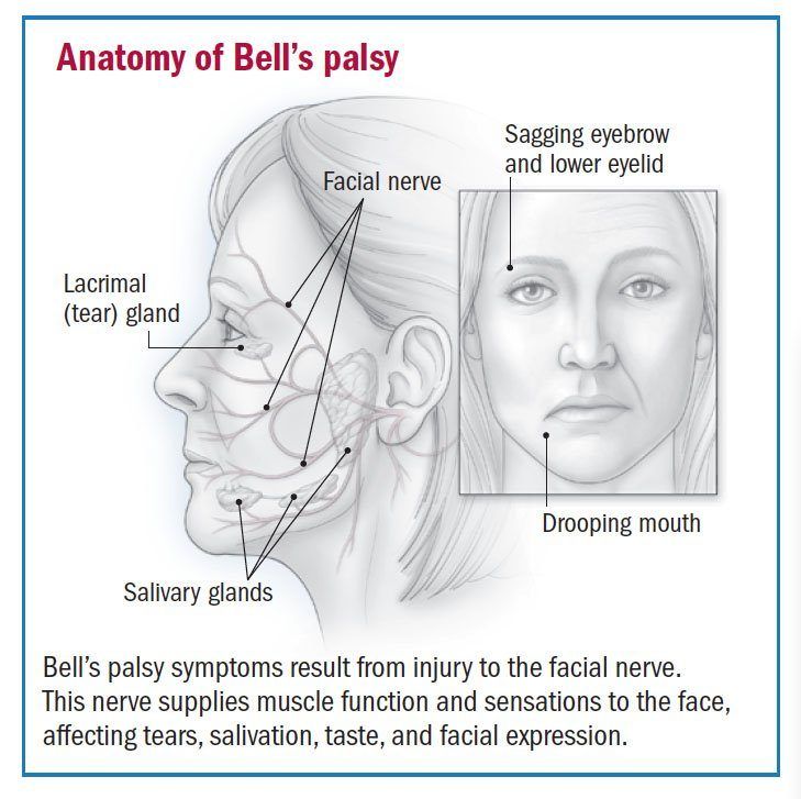 best of Exercise for palsy Facial bells