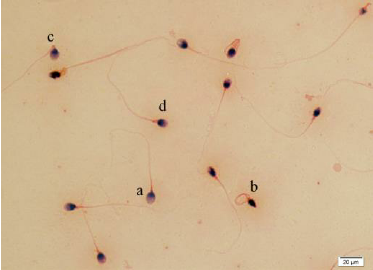 Papanicolau stain and sperm