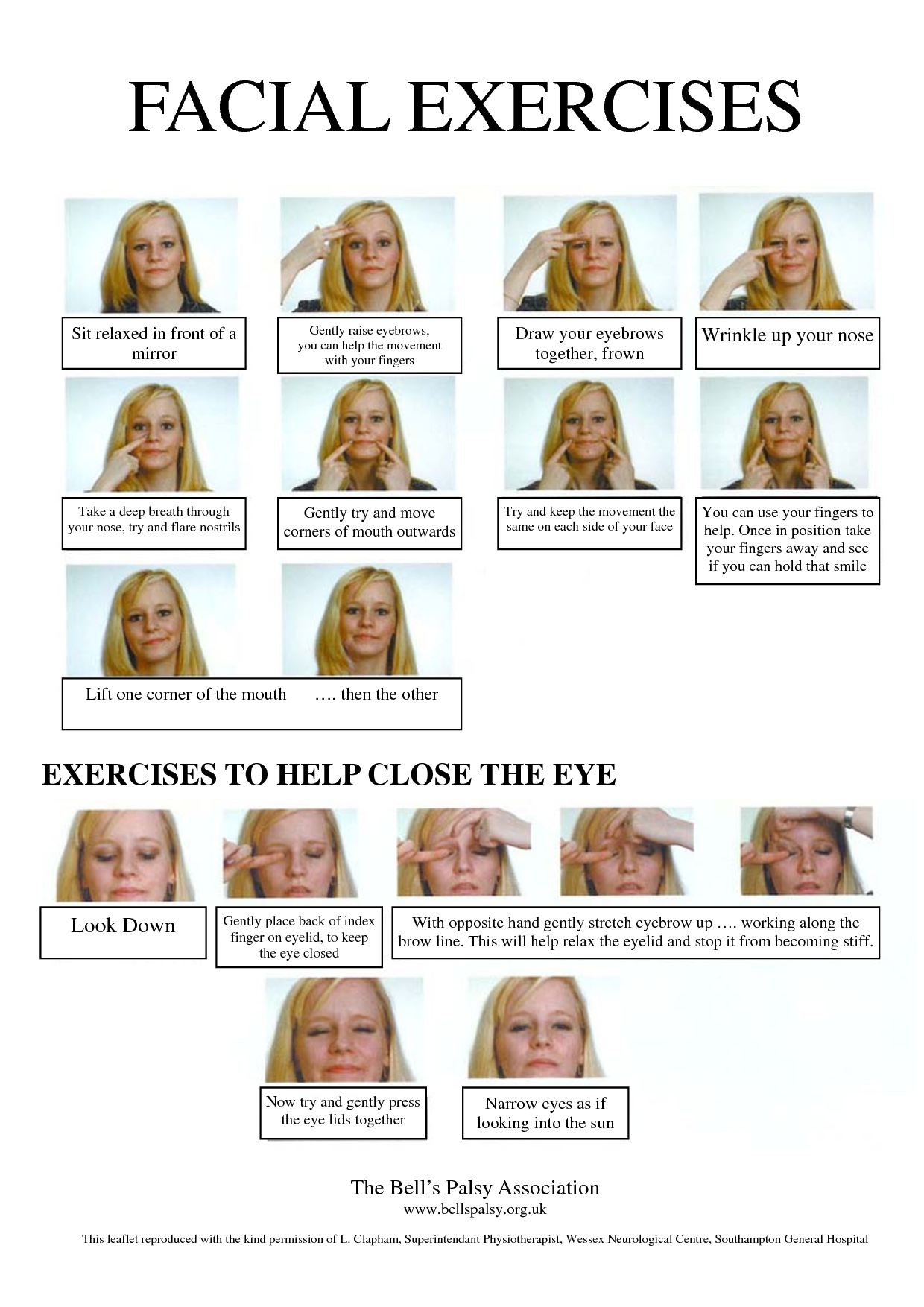 best of Exercise for palsy Facial bells
