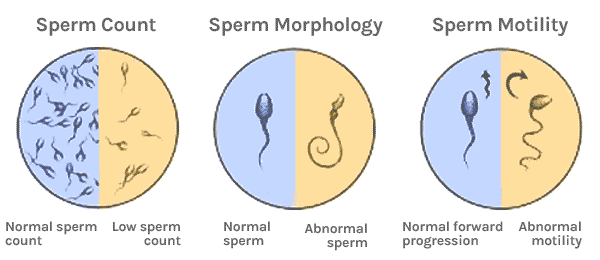 Difference between women sperm men