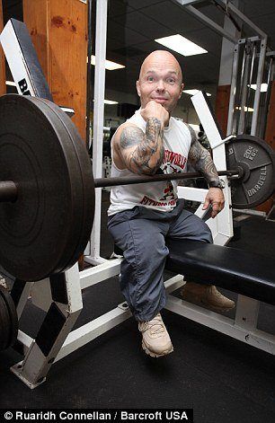 Albino midget down syndrome