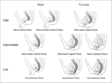 Scientific picture of a female anus