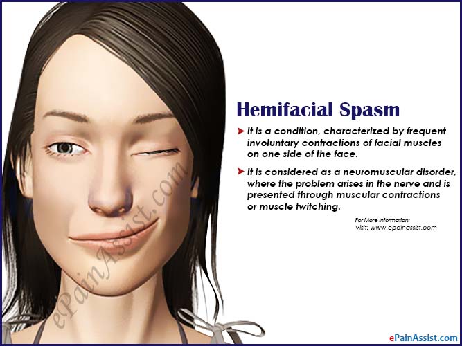 Facial mucle spasms