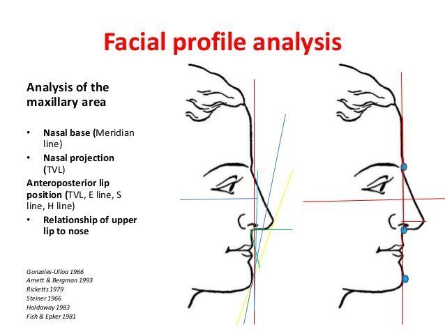Dino reccomend Facial analysis facial profile
