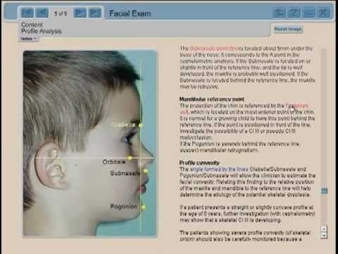 Reno reccomend Facial analysis facial profile