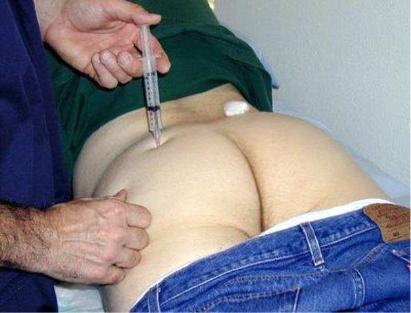 Medical Fetish Injection Exam Butt Nude Pics
