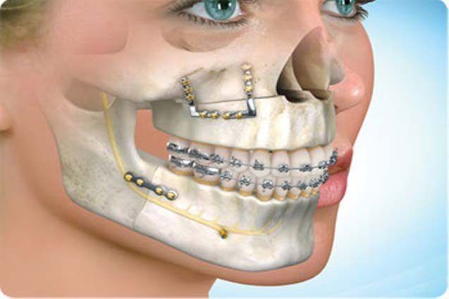 Redvine reccomend Oral and maxillofacial trauma