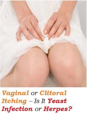Yeast infection clitoris itching